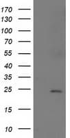 Monoclonal Mouse anti-Human SOCS3 Antibody (clone OTI11C5, IF, WB)