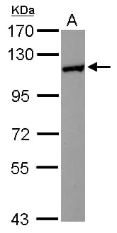 HIP1R Antibody (N-Terminus)