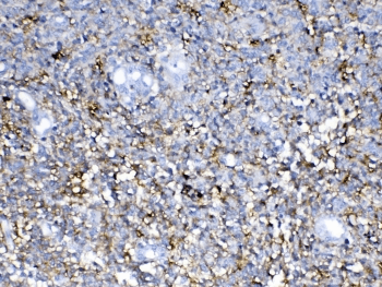 Polyclonal Rabbit anti-Human NCAN / Neurocan Antibody (IHC, WB)