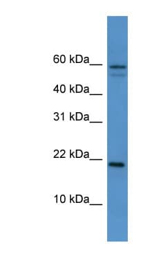 Polyclonal Rabbit anti-Mouse HSPB7 / CvHSP Antibody (aa51-100, WB)