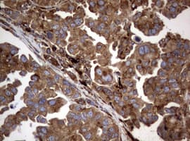 Monoclonal Mouse anti-Human PIK3C2A Antibody (clone OTI15H1, aa230-560, IHC, WB)