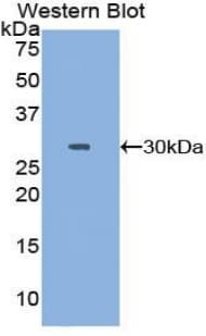 DNA Topoisomerase II Antibody (aa923-1148)