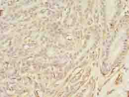 Polyclonal Rabbit anti-Human ASB11 Antibody (IHC)
