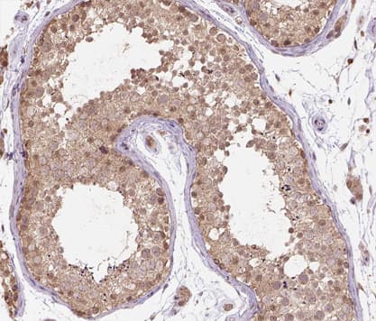 Polyclonal Rabbit anti-Human CUL2 / Cullin 2 Antibody (IHC, IF, WB)