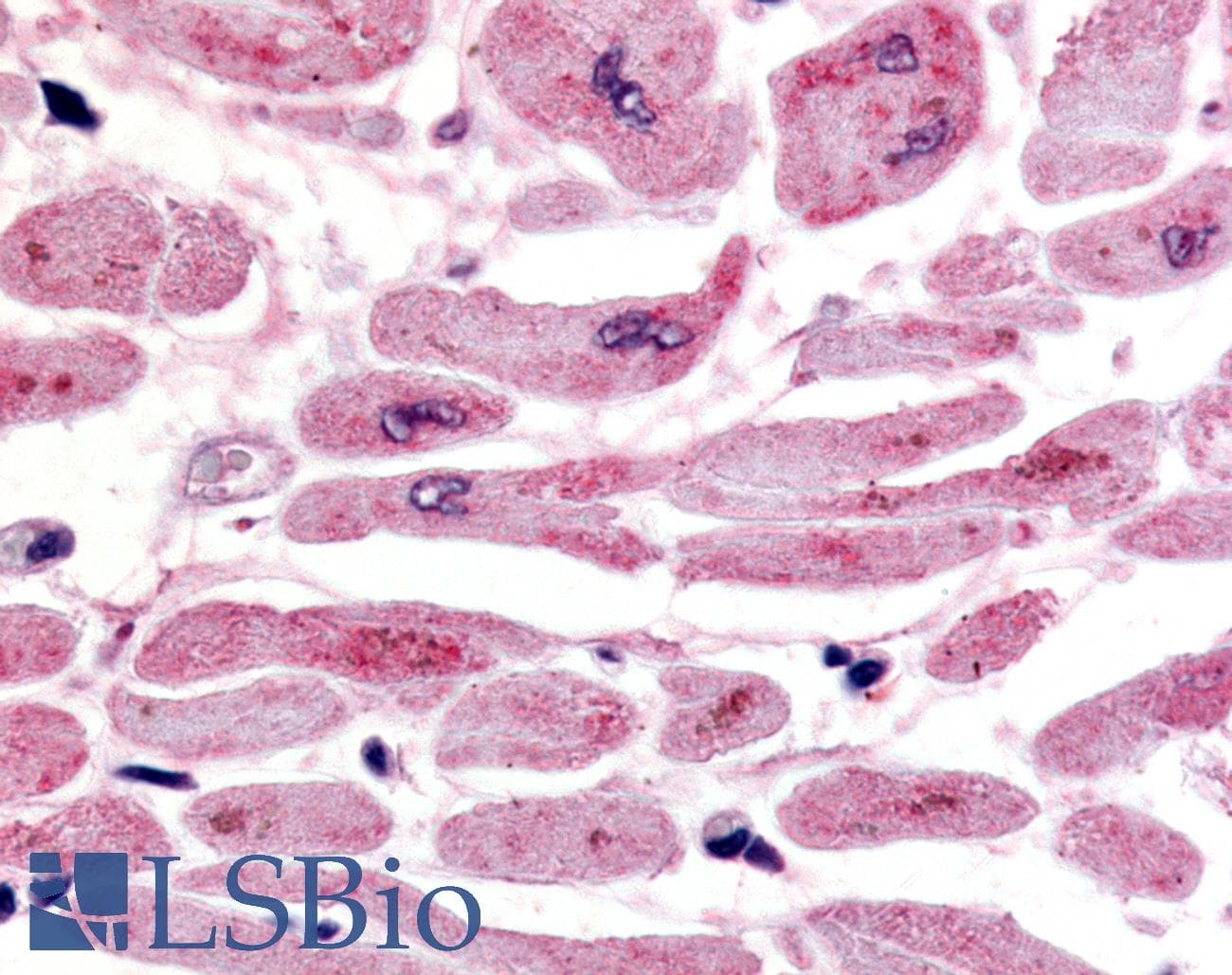 HIF2A / EPAS1 Antibody (C-Terminus, DY488)