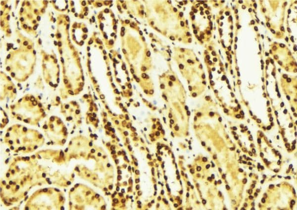 Polyclonal Rabbit anti-Human ERBB4 / HER4 Antibody (phospho-Tyr1284, IHC, IF, WB)