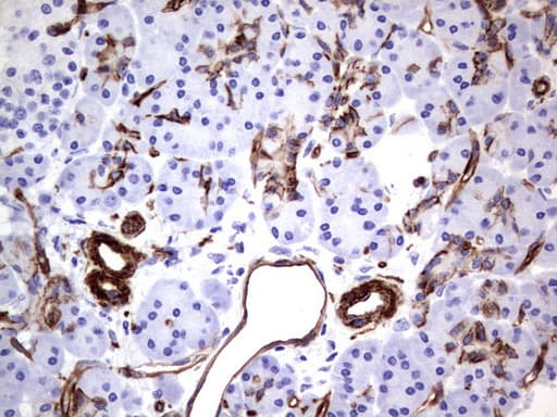 MCAM / CD146 Antibody (clone UMAB154)
