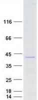 Human FOXL1 Protein (Recombinant Myc-DDK (Flag))