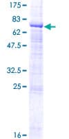 Human ZPLD1 Protein (Recombinant GST)