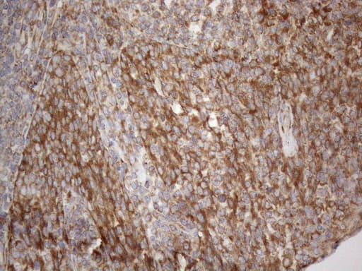 VAP33 / VAPA Antibody (aa2-227, clone OTI10E10)