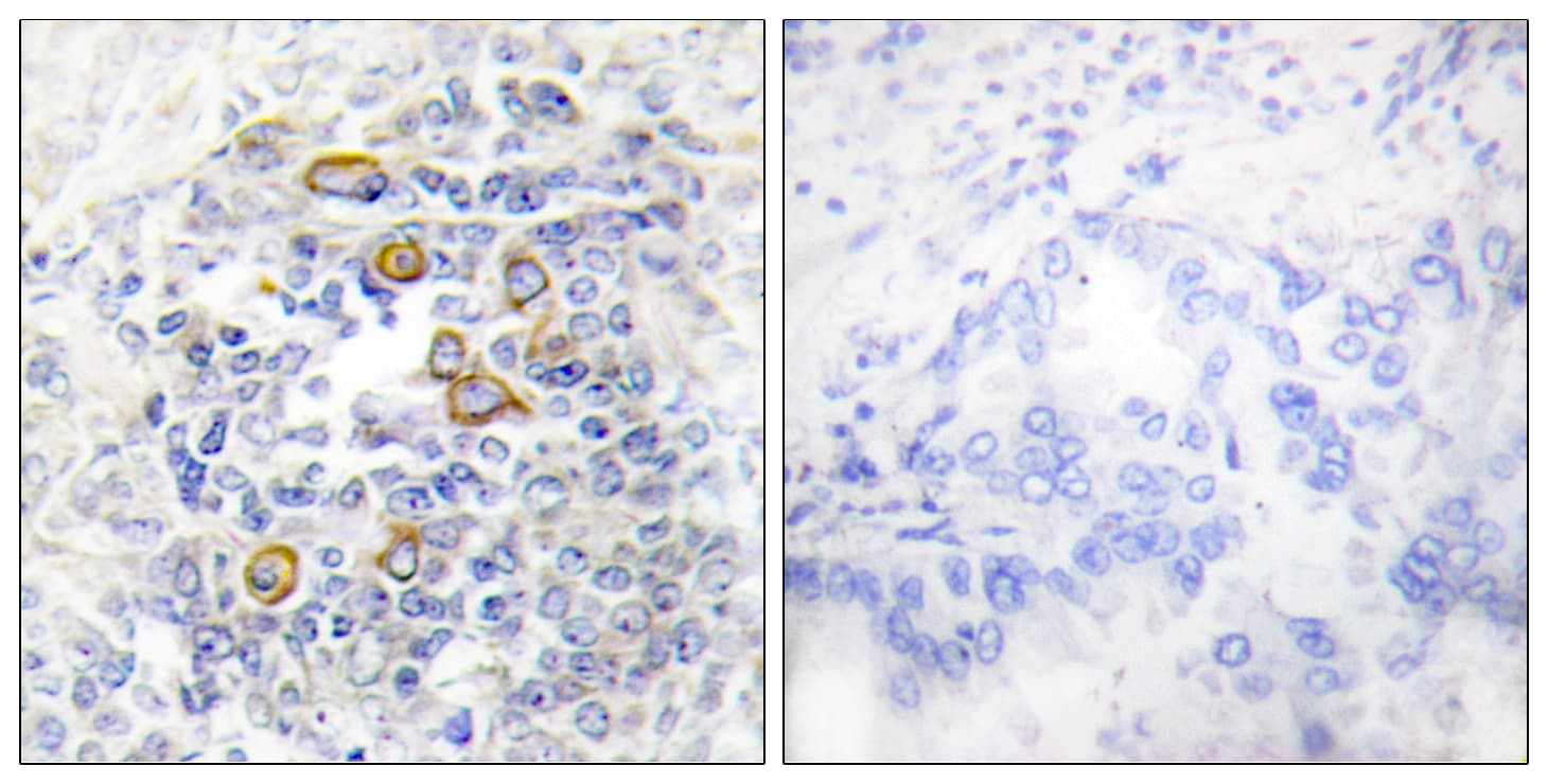 CD83 Antibody (aa101-150)
