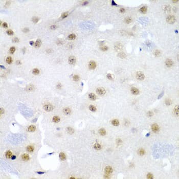 Polyclonal Rabbit anti-Human CDC27 Antibody (IHC, WB)