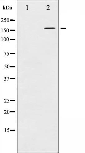 FLT1 / VEGFR1 Antibody