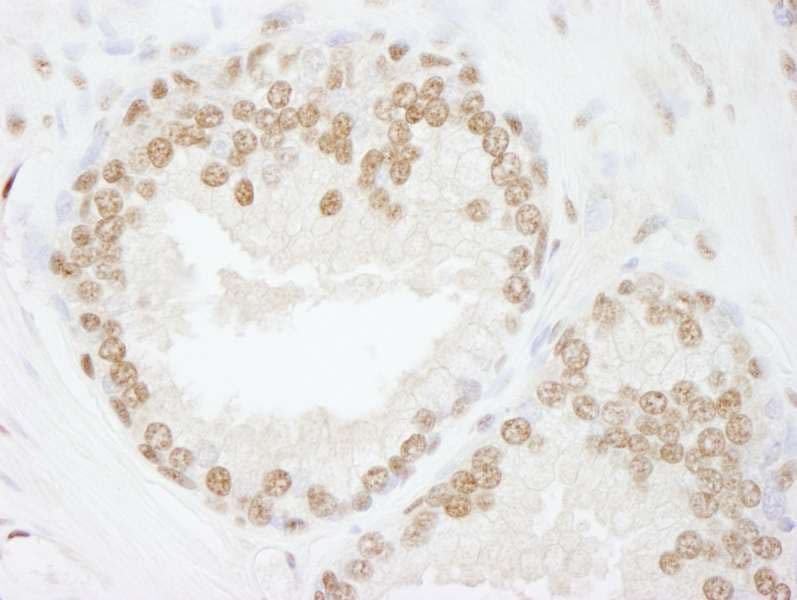 Polyclonal Rabbit anti-Human SMARCC2 Antibody (aa1164-C-term, IHC)