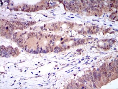 CASP8 / Caspase 8 Antibody (clone 1H11)