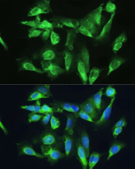 CTGF Antibody