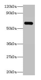 IHC-plus™ Polyclonal Rabbit anti-Human YARS / Tyrosyl-tRNA Synthetase Antibody (IHC, WB)