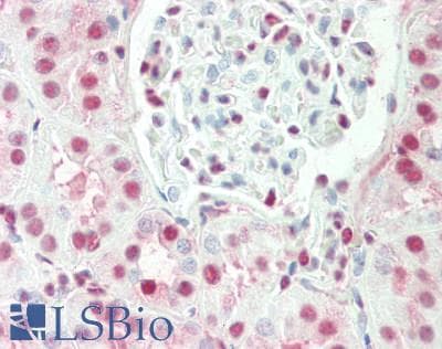 Polyclonal Rabbit anti-Human IRX3 Antibody (aa386-435, IHC, WB)