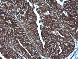 MAP2K1 / MKK1 / MEK1 Antibody (clone OTI2D2)