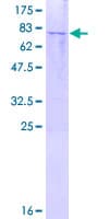 Human TRIM62 Protein (Recombinant GST)