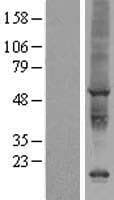 AIG1 Protein (Over-Expression Lysate Myc-DDK (Flag))