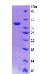 Human CISH / SOCS Protein (Recombinant His-T7)