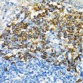 Polyclonal Rabbit anti-Human FGFR2 / FGF Receptor 2 Antibody (IHC, IF, WB)