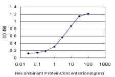 Monoclonal Mouse anti-Human CD105 Antibody (clone 4C11, WB)