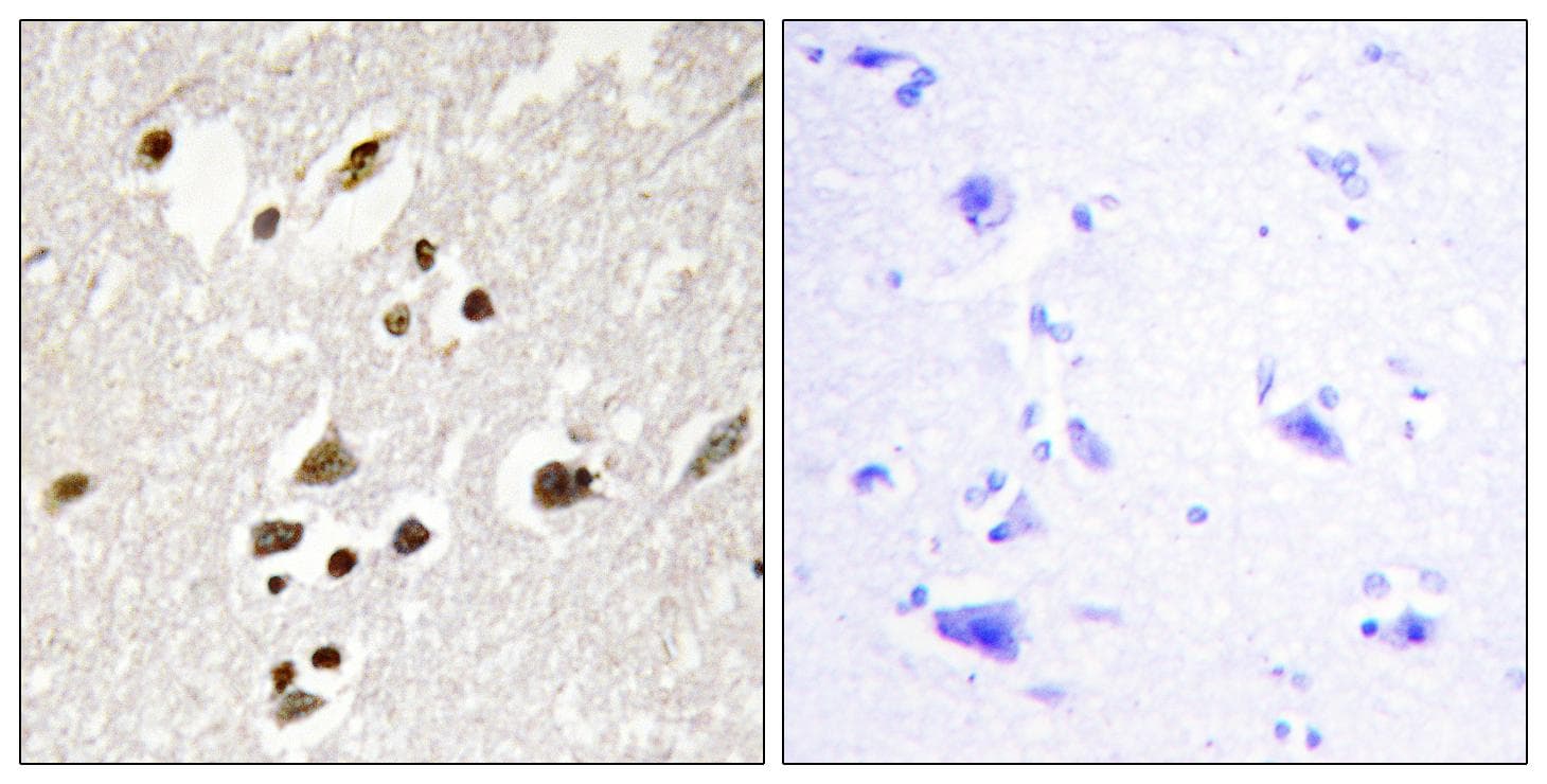 IRF3 Antibody (phospho-Ser385)