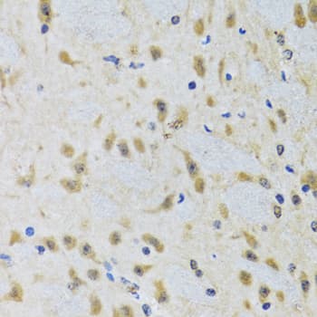 Polyclonal Rabbit anti-Human Apg7 / ATG7 Antibody (IHC, WB)