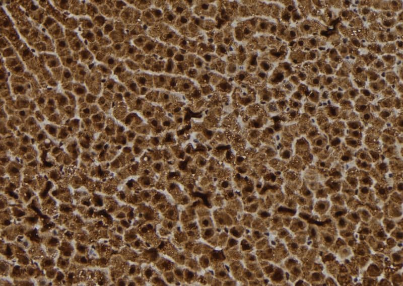 Polyclonal Rabbit anti-Human BCMP84 / S100A14 Antibody (IHC, WB)
