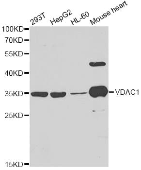 Polyclonal Rabbit anti-Human VDAC1 / PORIN Antibody (aa1-283, IHC, IF, WB)