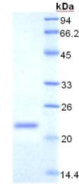Rat CD71 / Transferrin Receptor Protein (Recombinant His, N-Terminal)