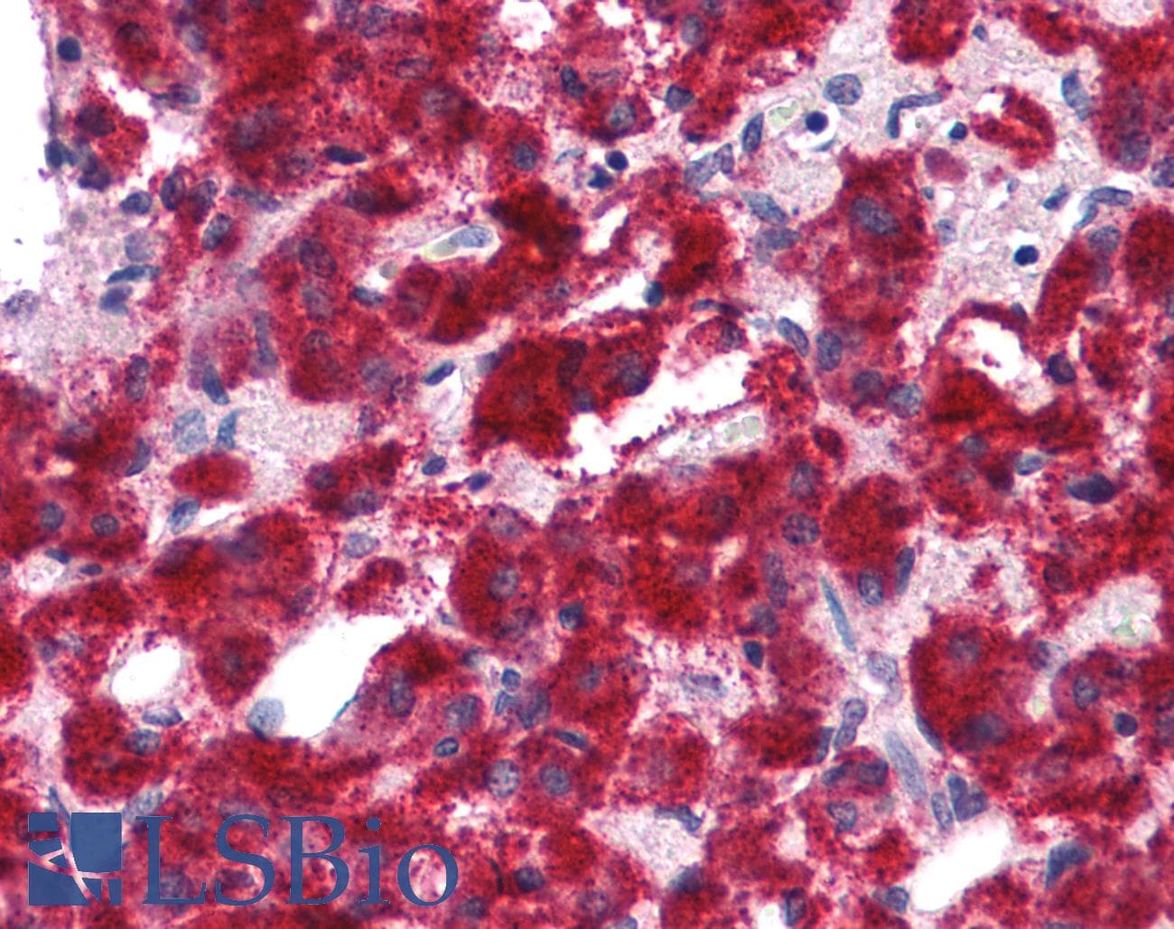 IHC-plus™ Polyclonal Rabbit anti-Human ANAPC13 Antibody (IHC, IF, WB)