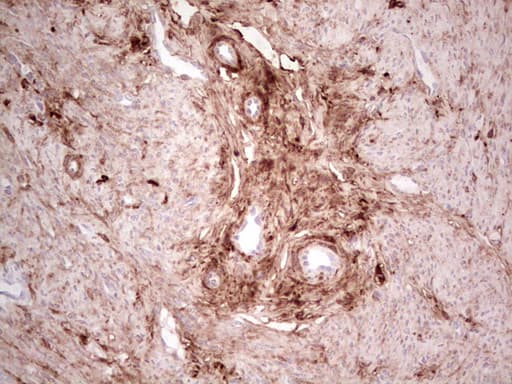 CSNK1G1 / CKI-Gamma 1 Antibody (aa163-422, clone OTI4D9)