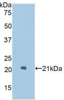 LAMP2 / CD107b Antibody (aa191-362)