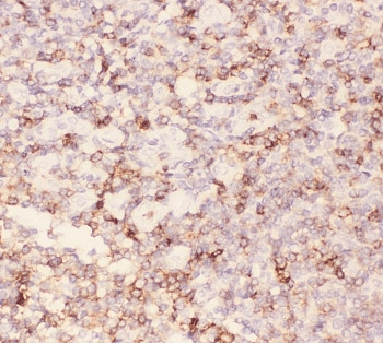 SPN / CD43 Antibody