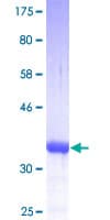 Human S100A10 Protein (Recombinant GST)