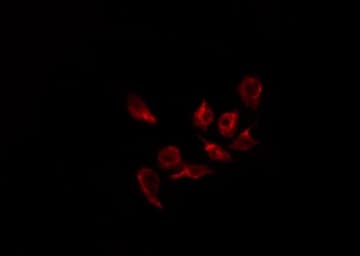 EFNB1 / Ephrin B1 Antibody