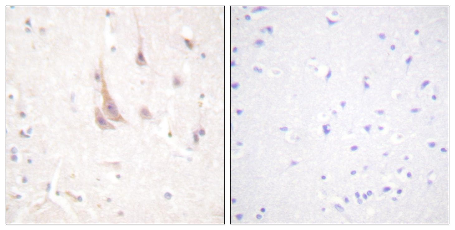 Polyclonal Rabbit anti-Human PRKCZ / PKC-Zeta Antibody (p560, IHC, IF, WB)