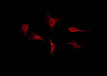 HNRNPL / hnRNP L Antibody