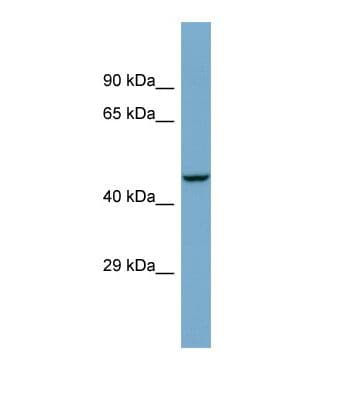 ZSCAN21 / Zipro1 Antibody (aa61-110)