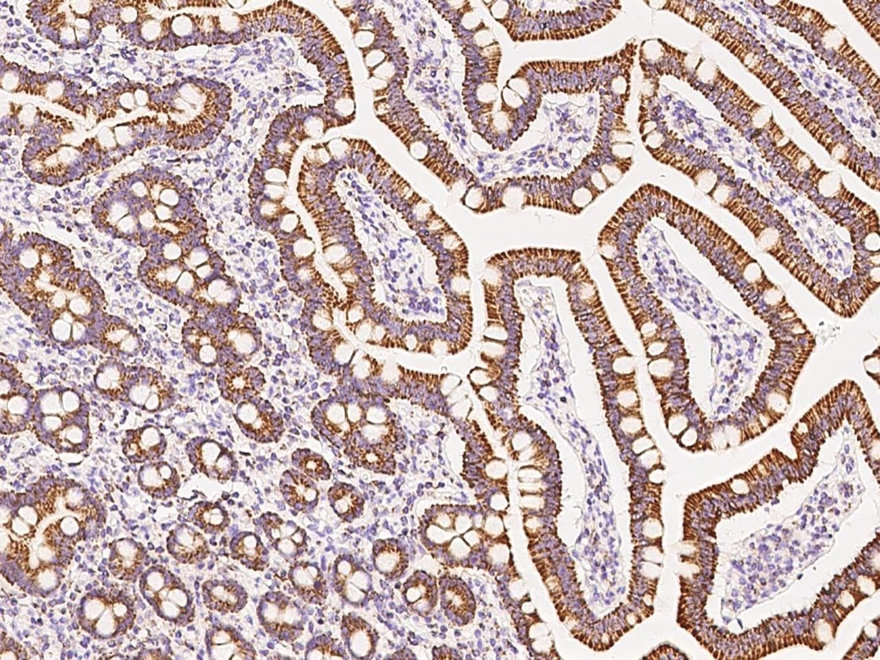 Polyclonal Rabbit anti-Human ATP5B / ATP Synthase Beta Antibody (Preservative Free, IHC, WB)
