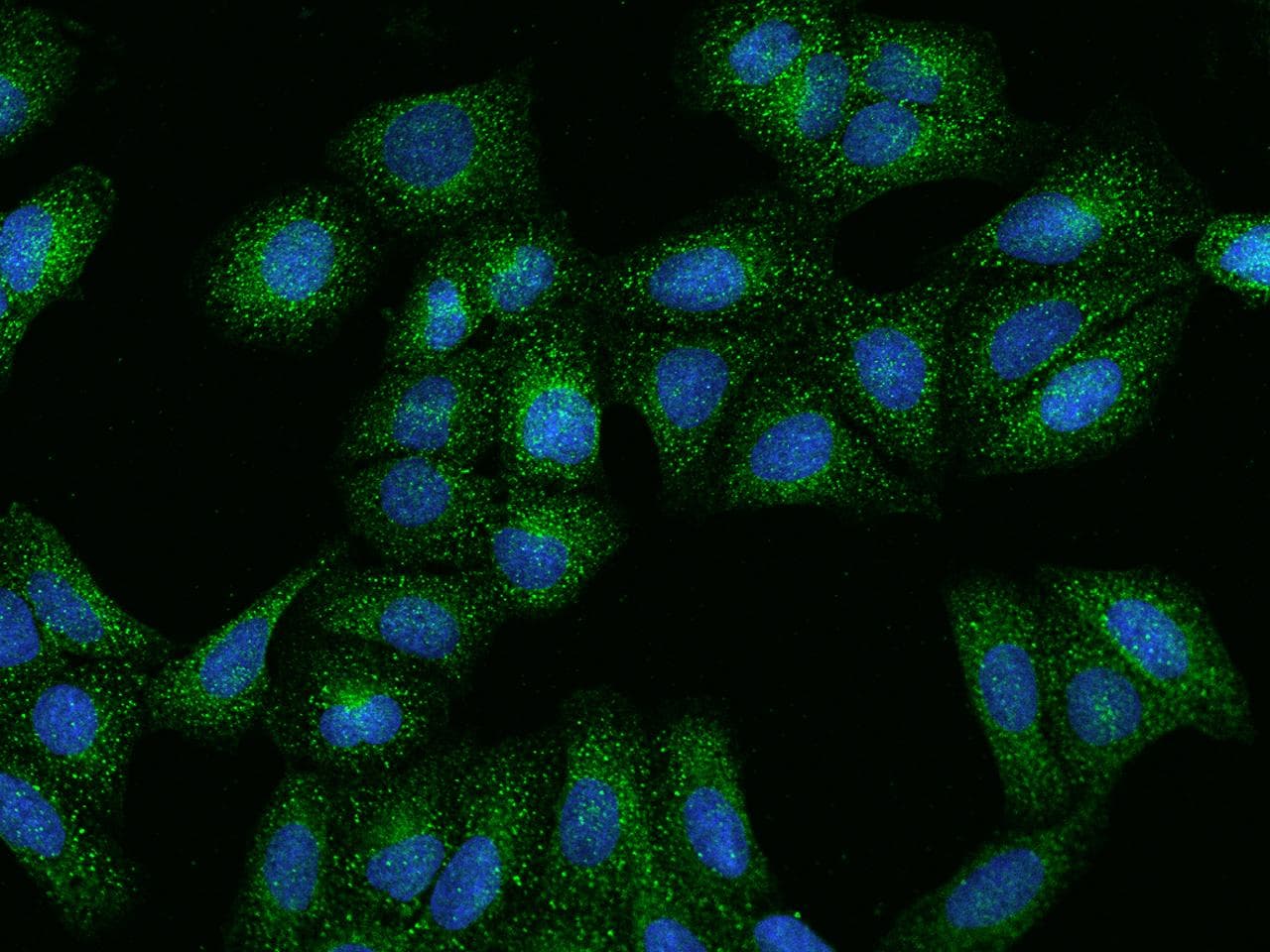HGF / Hepatocyte Growth Factor Antibody (Preservative Free)