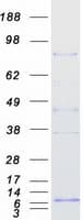 Human TLE2 Protein (Recombinant Myc-DDK (Flag))