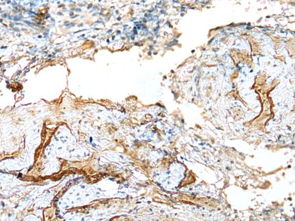 LDHD / Lactate Dehydrogenase D Antibody