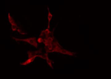 Polyclonal Rabbit anti-Human CYP4B1 Antibody (IHC, IF, WB)