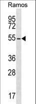 Polyclonal Rabbit anti-Human PRKAR2B Antibody (aa32-62, WB)