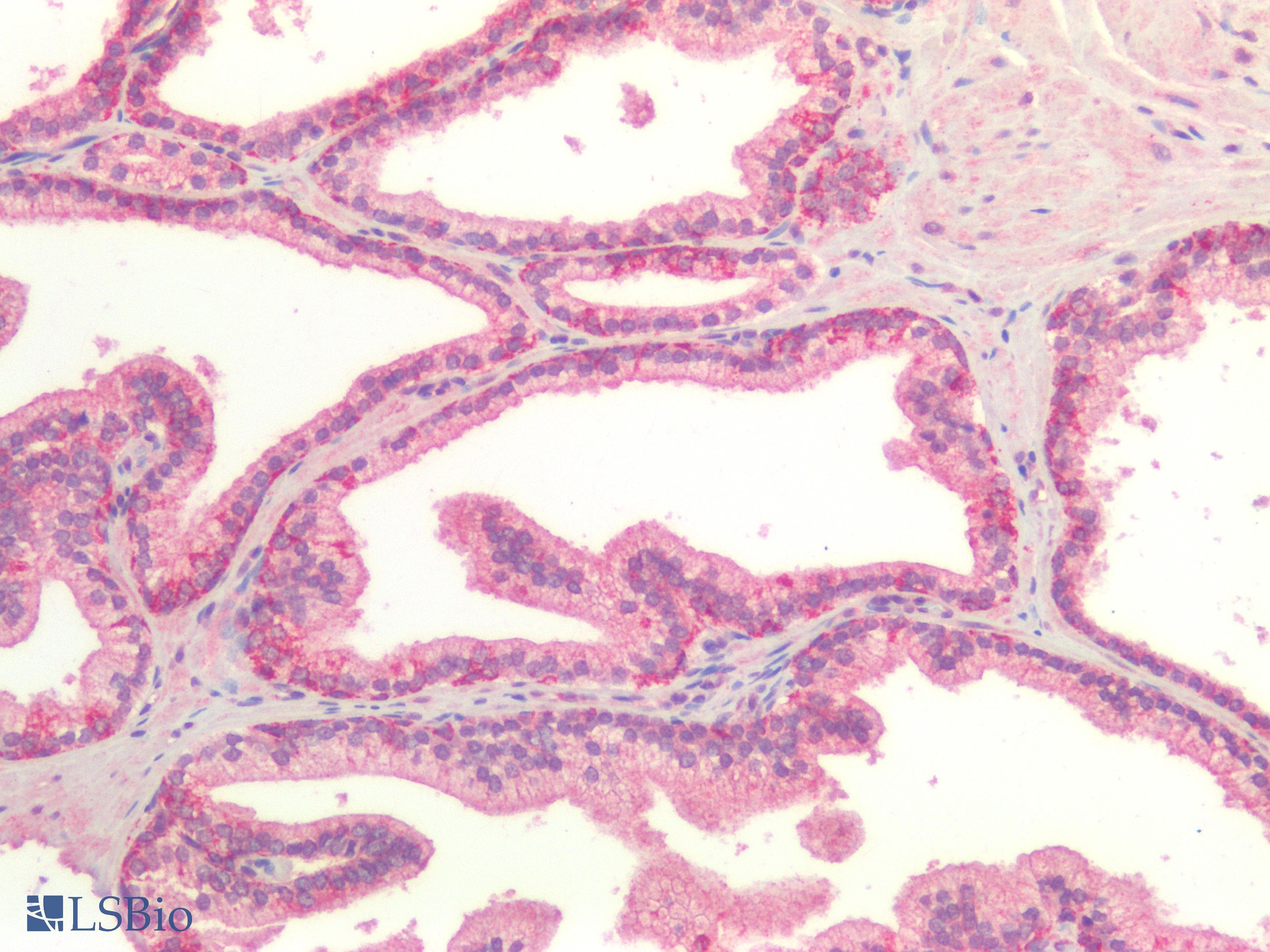PathPlus™ Polyclonal Rabbit anti-Human TJP1 / ZO-1 Antibody (IHC)