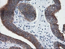 LCMT1 Antibody (clone OTI 1G5)